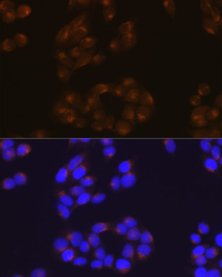 [KO Validated] APP Rabbit mAb