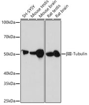 βIII-Tubulin Rabbit mAb