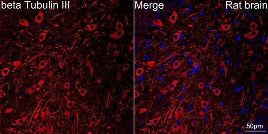 βIII-Tubulin Rabbit mAb