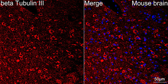 βIII-Tubulin Rabbit mAb