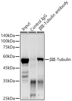βIII-Tubulin Rabbit mAb