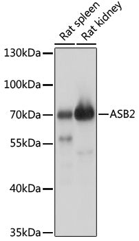 ASB2 Rabbit pAb