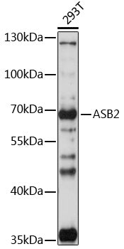 ASB2 Rabbit pAb