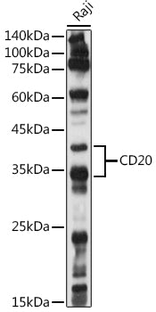 CD20 Rabbit pAb
