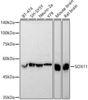 SOX11 Rabbit pAb