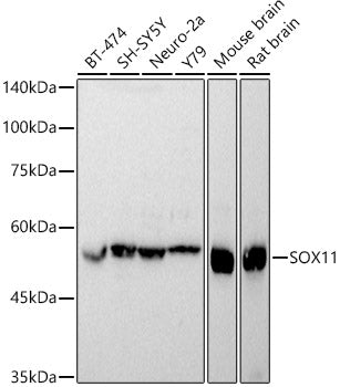 SOX11 Rabbit pAb