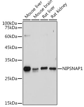 NIPSNAP1 Rabbit pAb