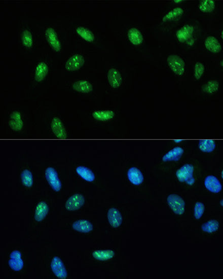 DHX9/RNA Helicase A Rabbit pAb