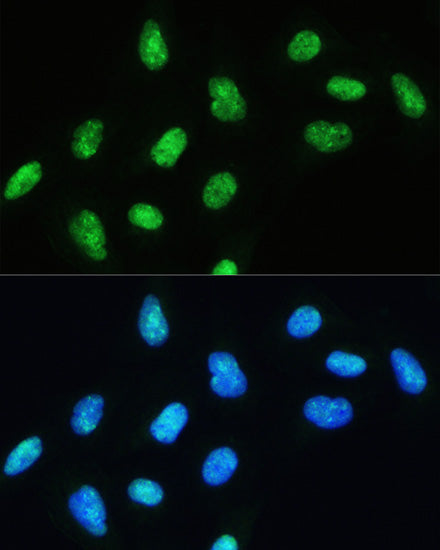 DHX9/RNA Helicase A Rabbit pAb