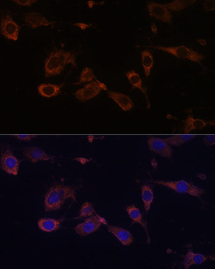 MT-ATP6 Rabbit pAb