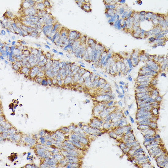 MT-CYB Rabbit pAb