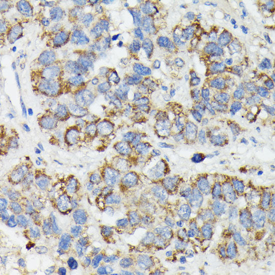 MT-CYB Rabbit pAb