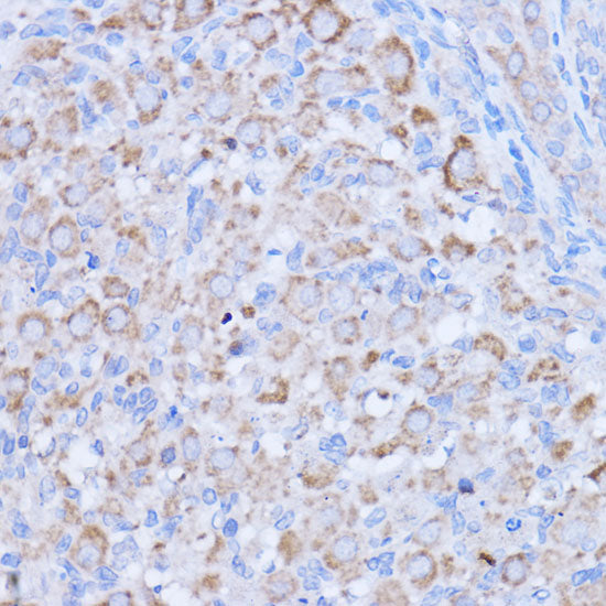 MT-ND1 Rabbit pAb