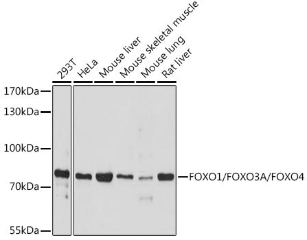 FOXO1/FOXO3A/FOXO4 Rabbit pAb