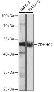 ZDHHC2 Rabbit pAb