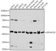 ZDHHC20 Rabbit pAb