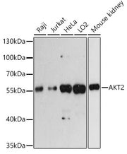 AKT2 Rabbit pAb
