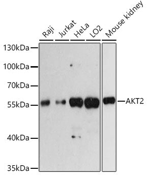 AKT2 Rabbit pAb