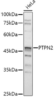 [KO Validated] PTPN2 Rabbit pAb