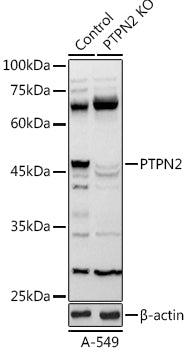 [KO Validated] PTPN2 Rabbit pAb