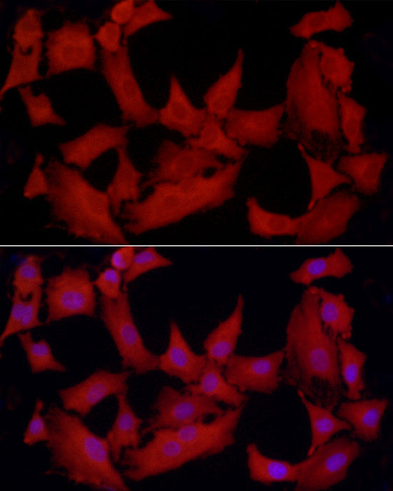 [KO Validated] PTPN2 Rabbit pAb