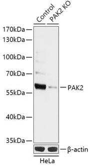 [KO Validated] PAK2 Rabbit pAb