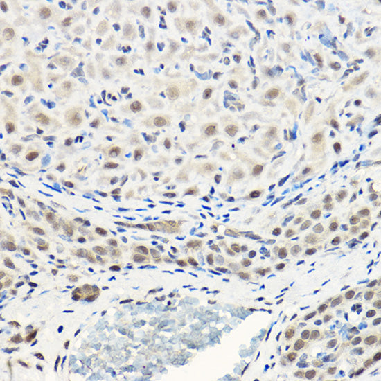 Pan-Akt Rabbit pAb