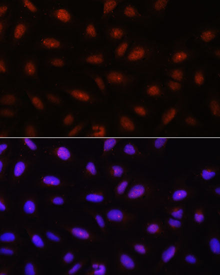 Pan-Akt Rabbit pAb