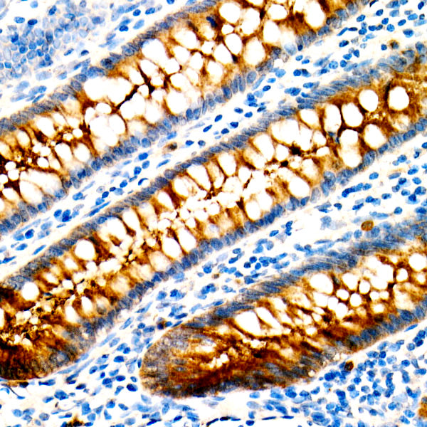 CEACAM5 Mouse mAb
