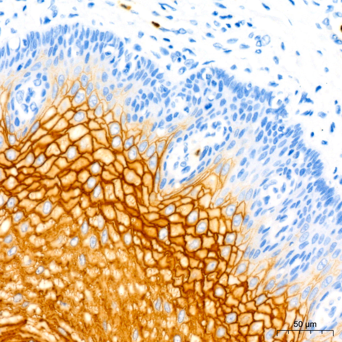 CEACAM5 Mouse mAb