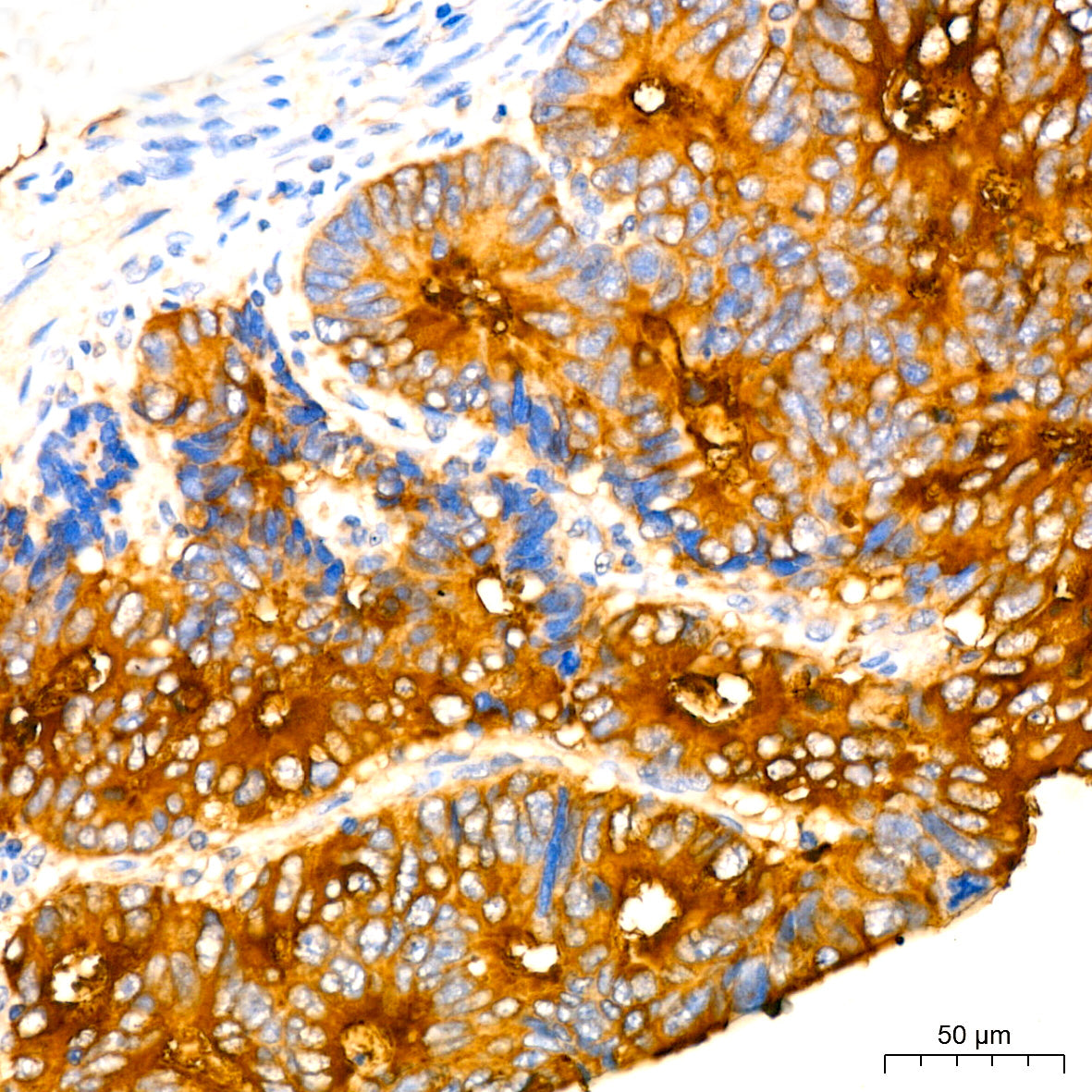 CEACAM5 Mouse mAb