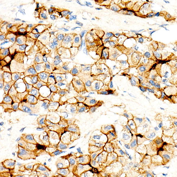 CEACAM5 Mouse mAb