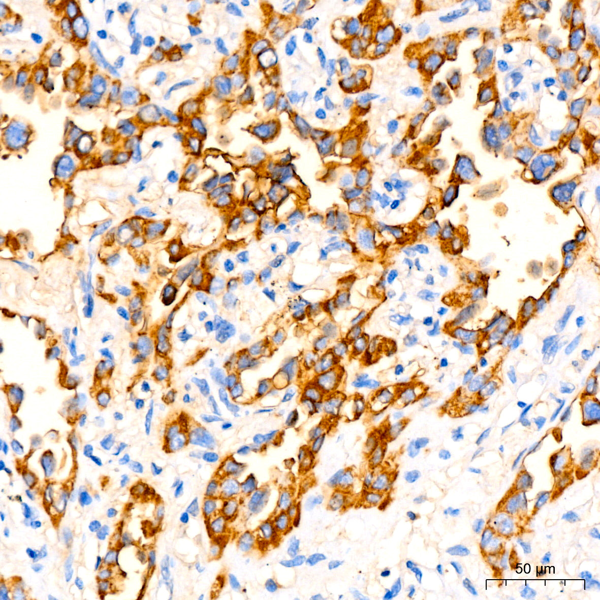 CEACAM5 Mouse mAb