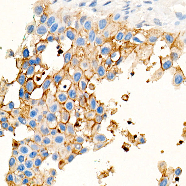 CEACAM5 Mouse mAb