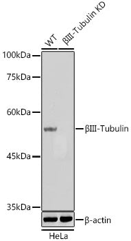 βIII-Tubulin Mouse mAb