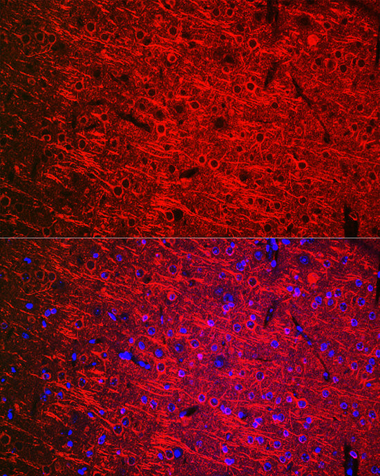 βIII-Tubulin Mouse mAb