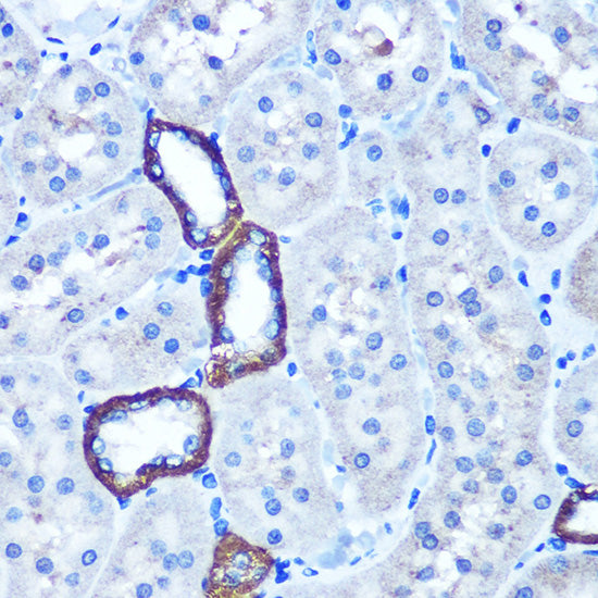 TBCCD1 Rabbit pAb