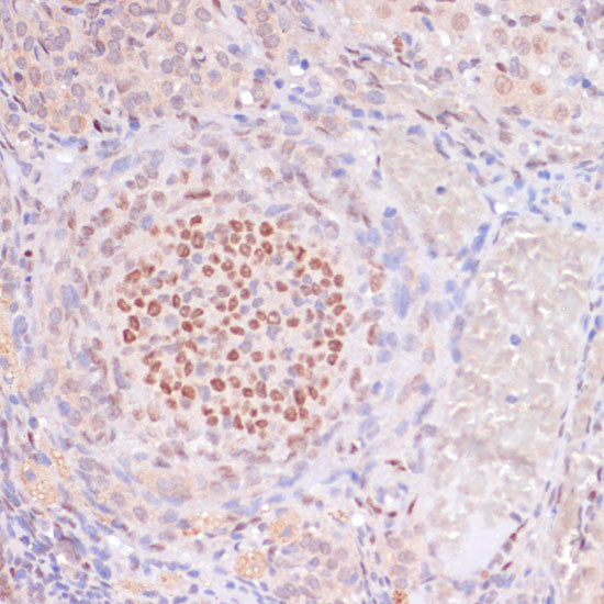 Acetyl-Histone H3-K23 Rabbit pAb
