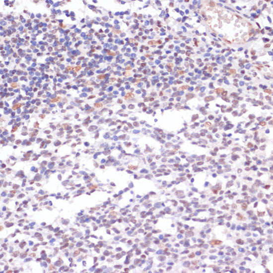 Acetyl-Histone H3-K23 Rabbit pAb