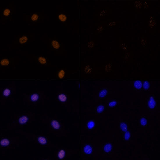 Acetyl-Histone H3-K23 Rabbit pAb