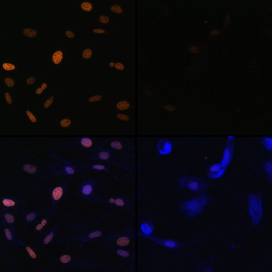 Acetyl-Histone H3-K23 Rabbit pAb