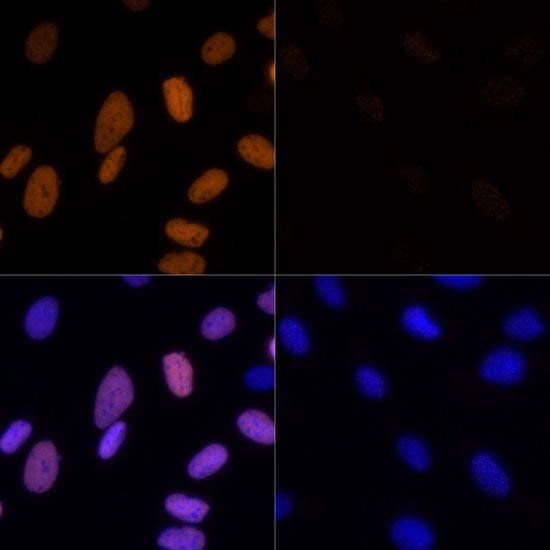 Acetyl-Histone H3-K23 Rabbit pAb