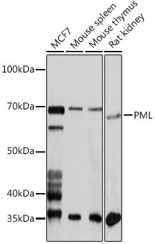 PML Rabbit pAb
