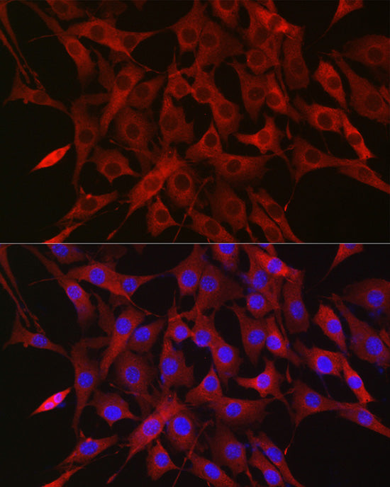 Ubiquitin Rabbit pAb