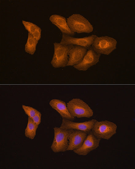 NF-kB p65/RelA Mouse mAb