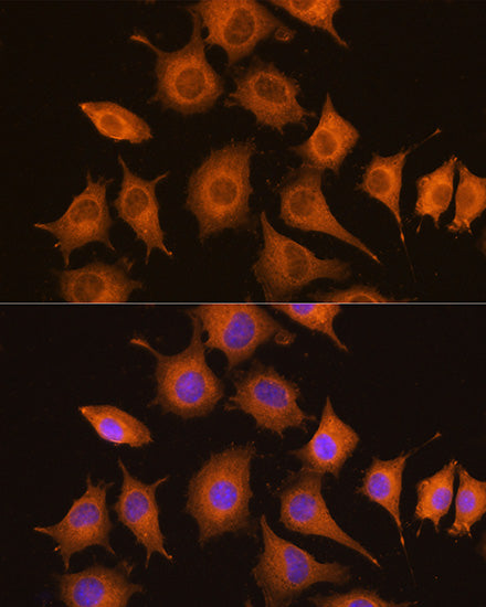 NF-kB p65/RelA Mouse mAb