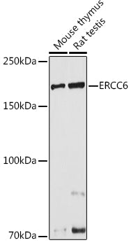ERCC6 Rabbit pAb