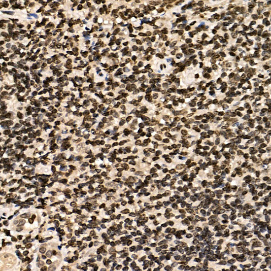 ERCC6 Rabbit pAb