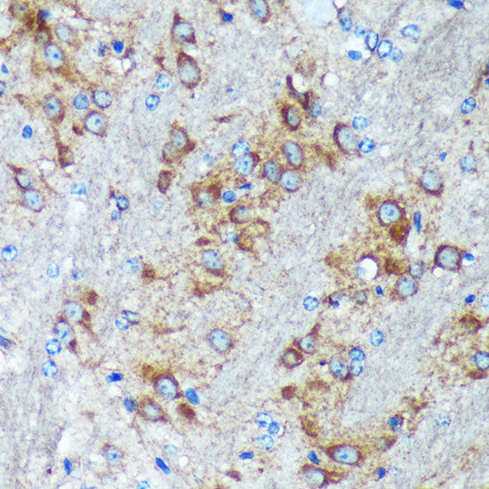 GRSF1 Rabbit pAb