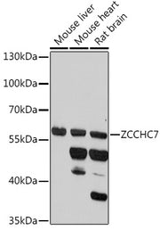 ZCCHC7 Rabbit pAb